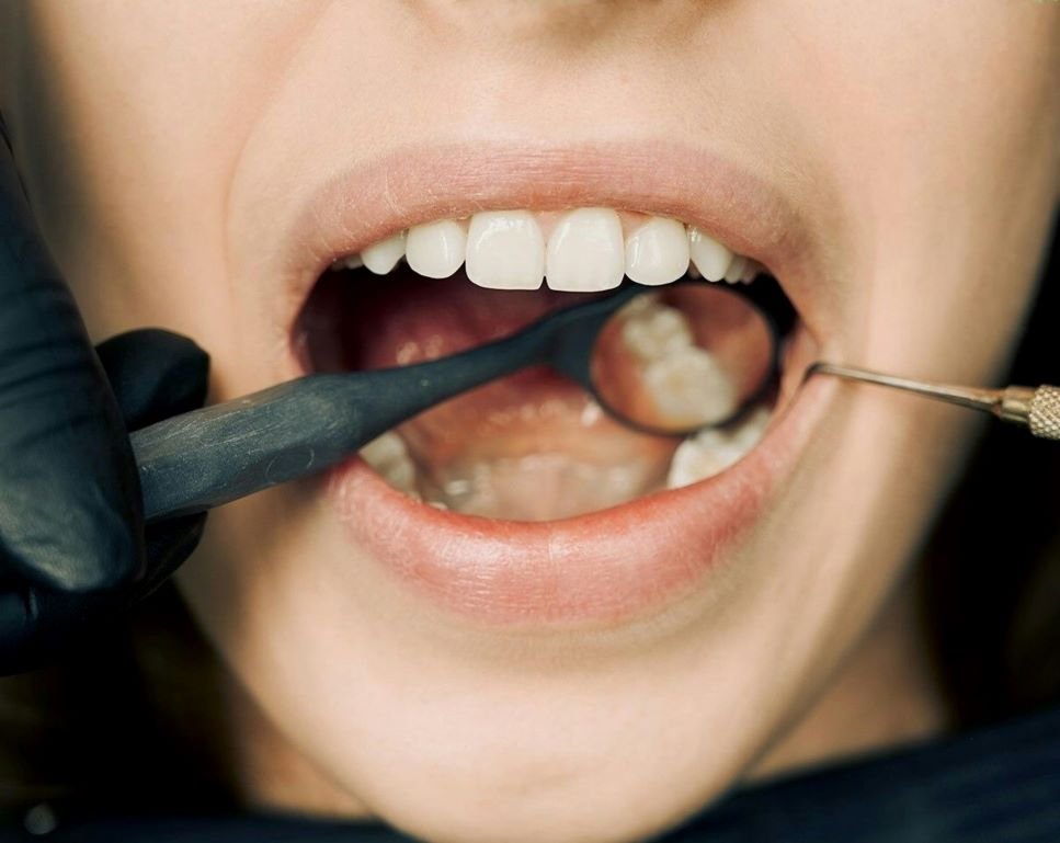 Periodontologinis gydymas