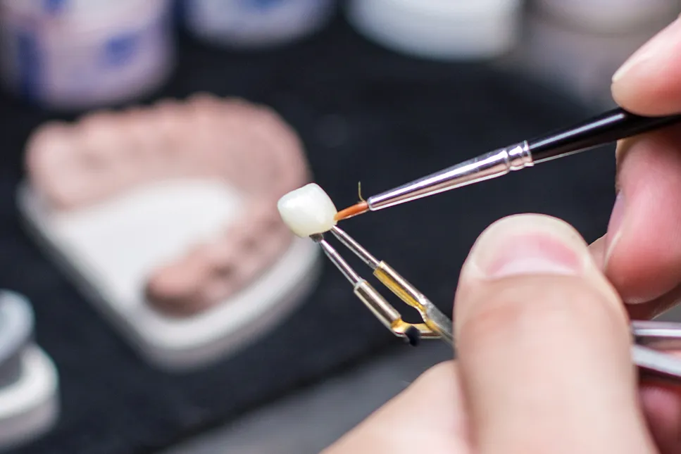 Dantų technikas teptuku dengia keraminės dantų karūnėlės paviršių sluoksniavimo metu