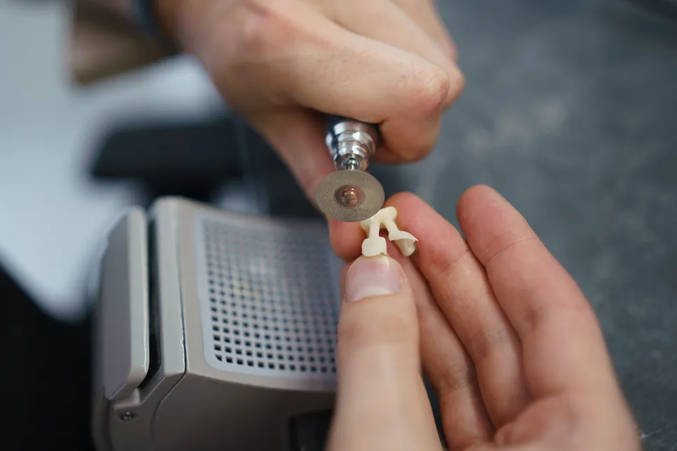 Dantų technikas šlifuoja keraminę dantų restauraciją naudojant specialų rotacinį įrankį