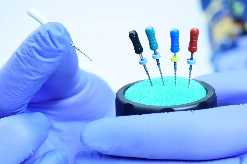 Endodontiniai dantų šaknų kanalų instrumentai odontologo rankose, naudojami kanalų valymui ir gydymui